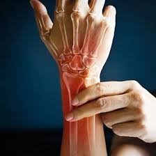 Arthritis &mdash; joint pain relief through homoeopathy